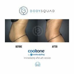 cooltone before/after from bodysquad