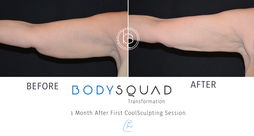 Transformation of the Week: Toned Arms Are Here! ? - The Body Squad