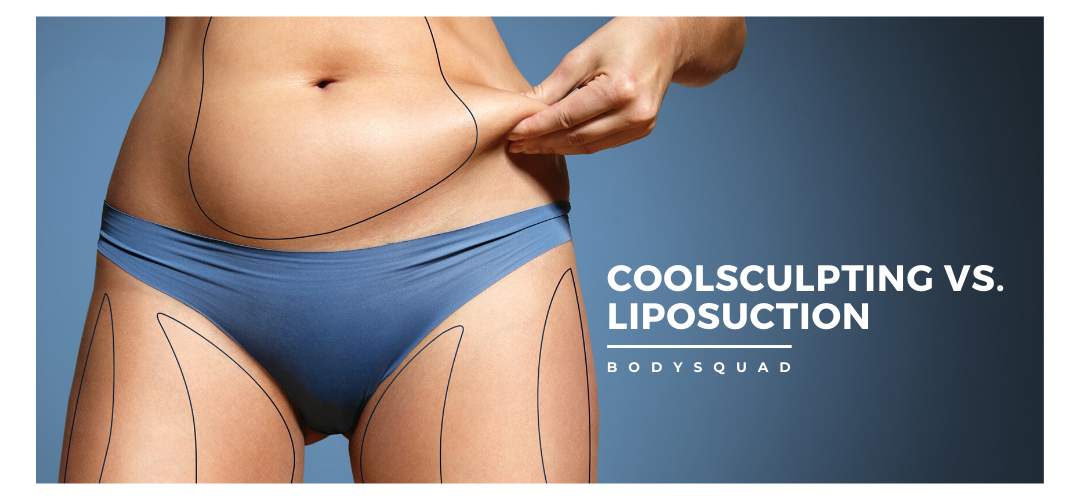 BodySquad banner "CoolSculpting vs. Liposuction"